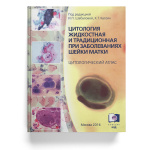 Вооружившись знаниями и опытом: «Цитология жидкостная и традиционная при заболеваниях шейки матки»