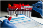 ФАС проверит цены на ПЦР-тестирование на COVID-19 в лабораториях